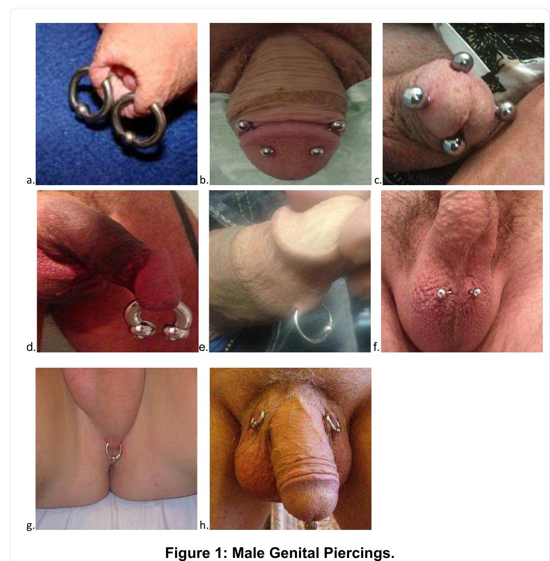 PDF) Complications of Genital Piercings
