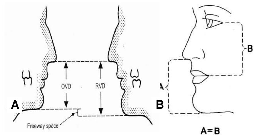 Rvf Vs Rvd A schematic of the ovd, rvd and fws; b schematic comparison