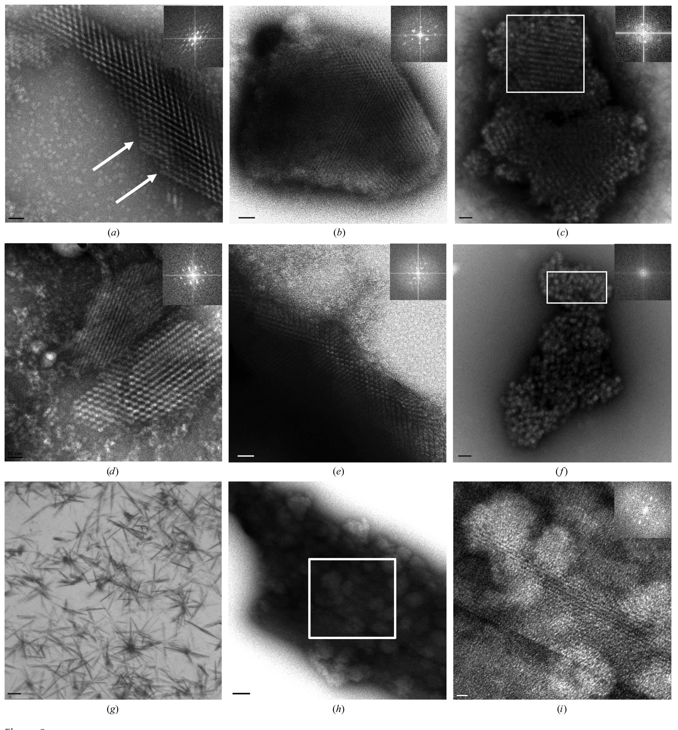 (PDF) Transmission electron microscopy for the evaluation and ...