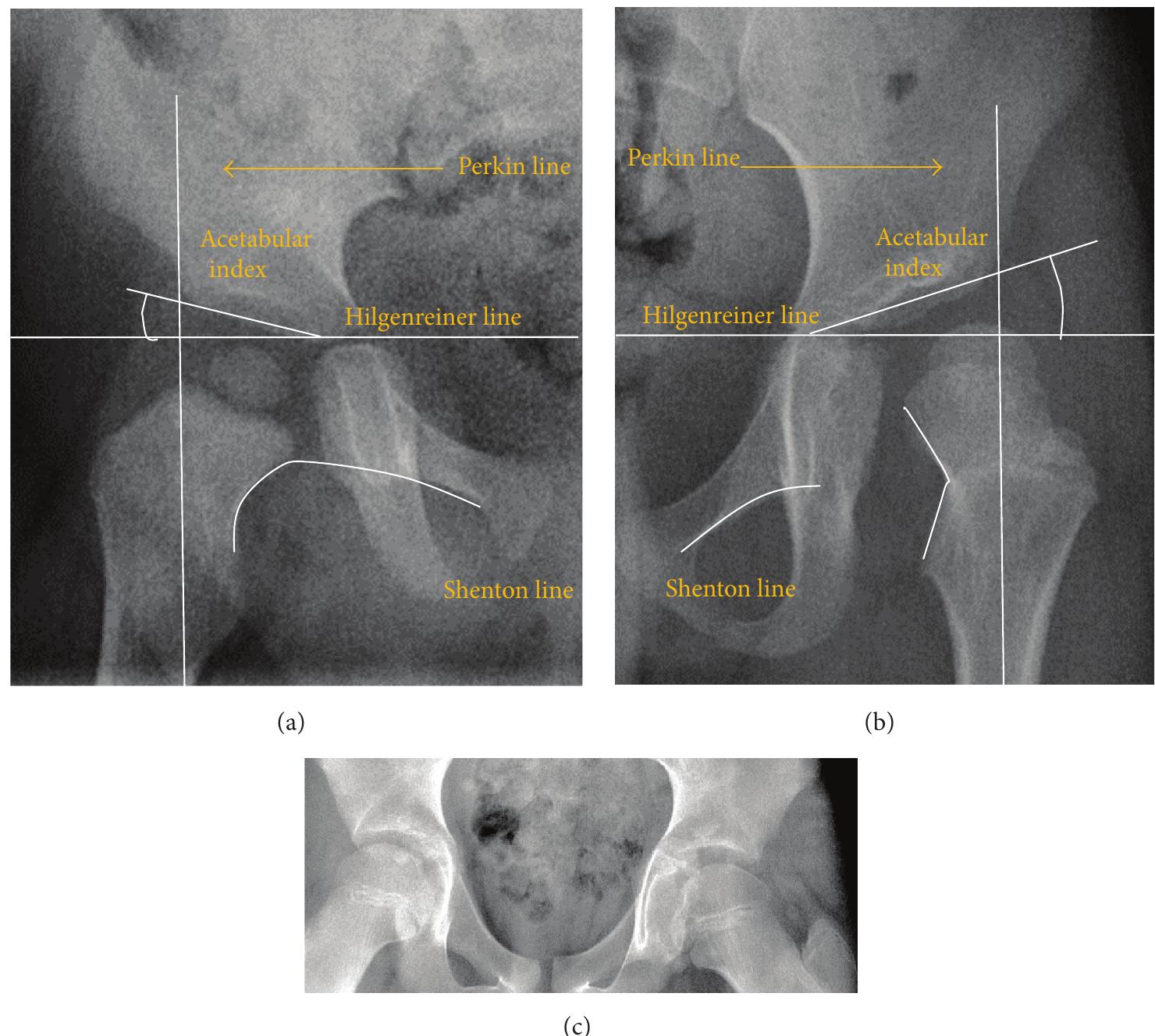 PDF Imaging Of Hip Pain From Radiography To Cross Sectional Imaging PDF Imaging Of Hip Pain From Radiography To Cross Sectional Imaging