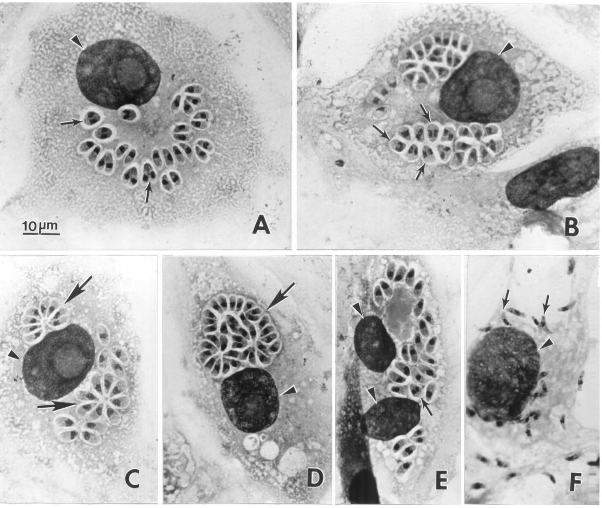 Stages of besnoitia darlingi. (a) section of a tissue cyst
