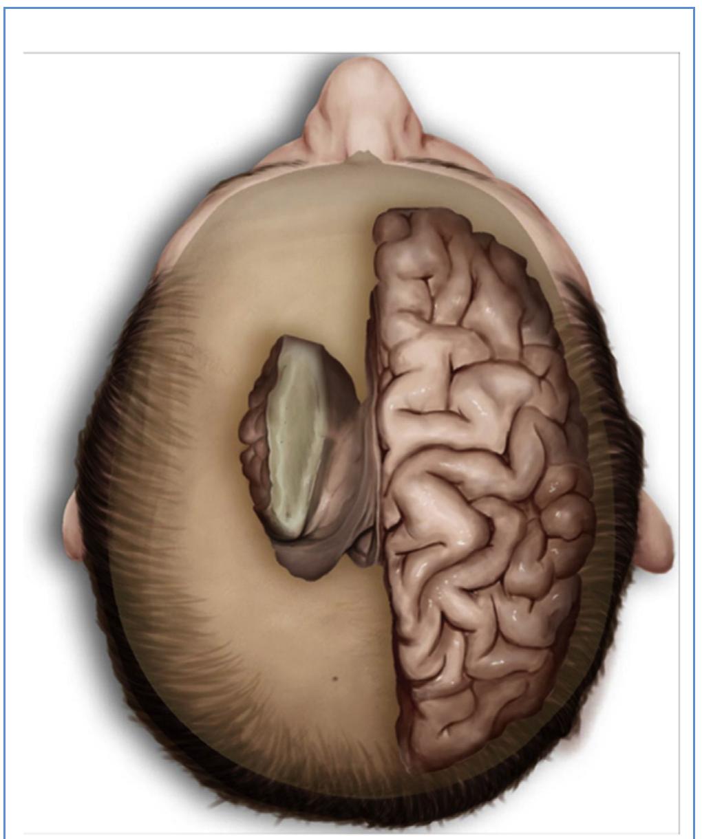 (PDF) Microsurgical Anatomy and Approaches to the Cerebral Central Core