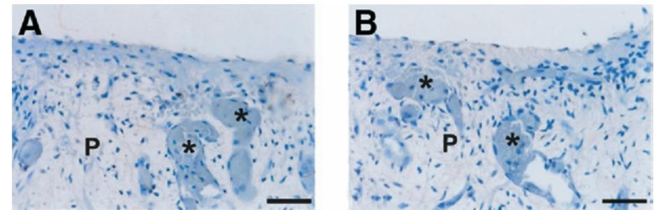 Capping Staining Patterns (PDF) Direct capping of human pulps with a dentin bonding system and ...