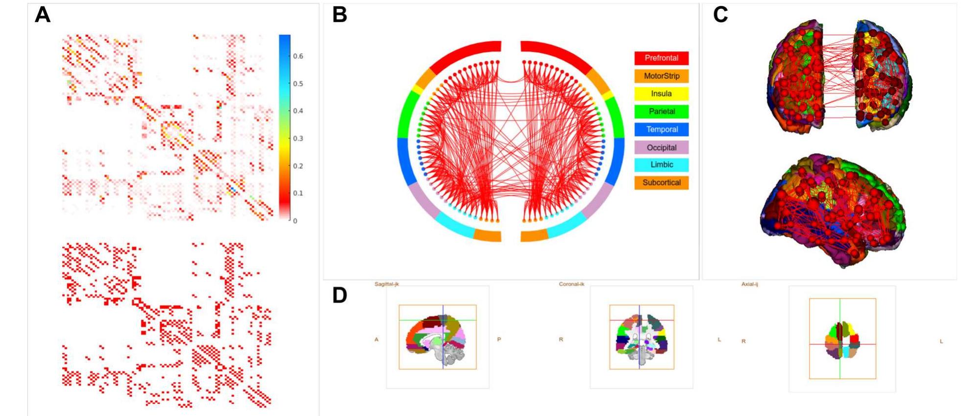 (PDF) Human brain structural connectivity matrices–ready for modelling