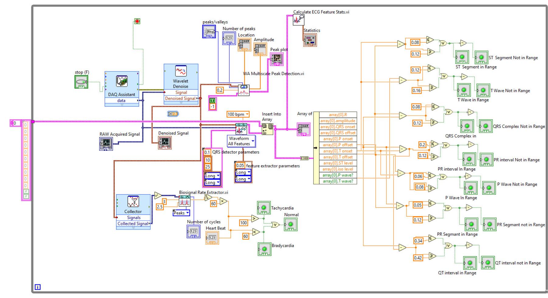 Labview Process Flow (PDF) Real -Time ECG Signal Acquisition and Processing Using LabVIEW
