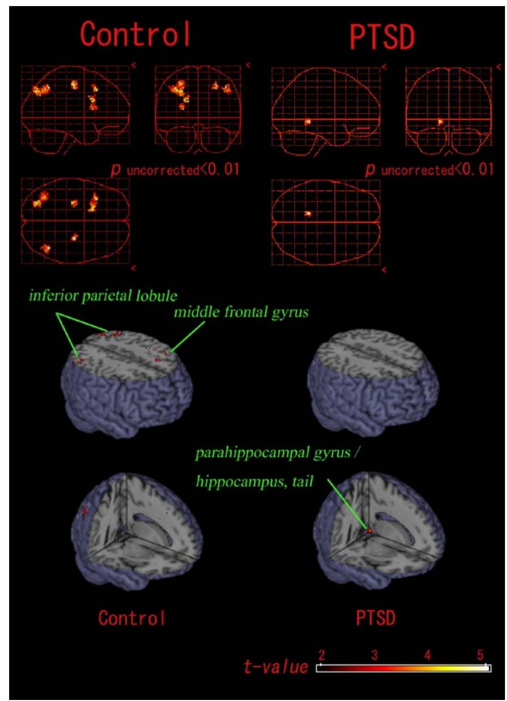 (PDF) Parahippocampal activation evoked by masked traumatic images in ...