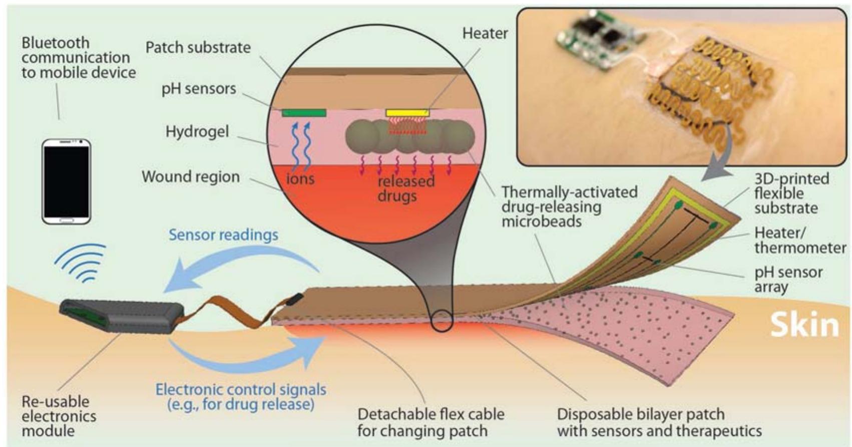(PDF) Smart Bandage for Monitoring and Treatment of Chronic Wounds