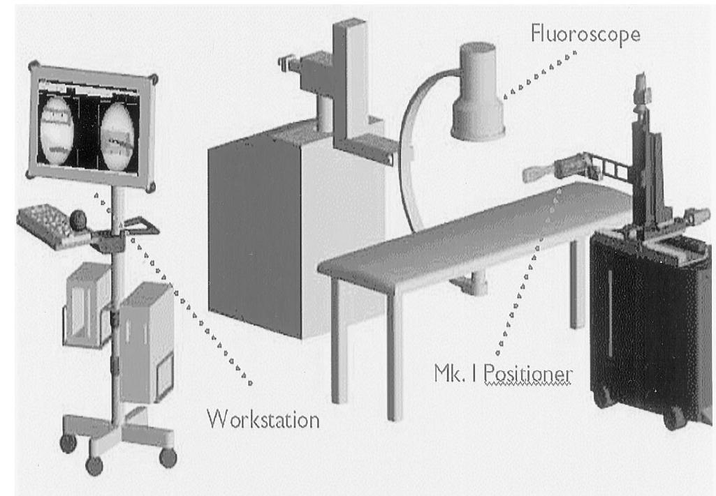 Illustration of the setup of the fgs system. the mark i