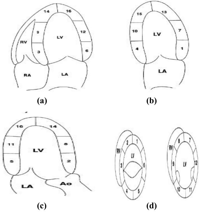 (PDF) Thrombus Detection from Echocardiographic Images Using Image ...