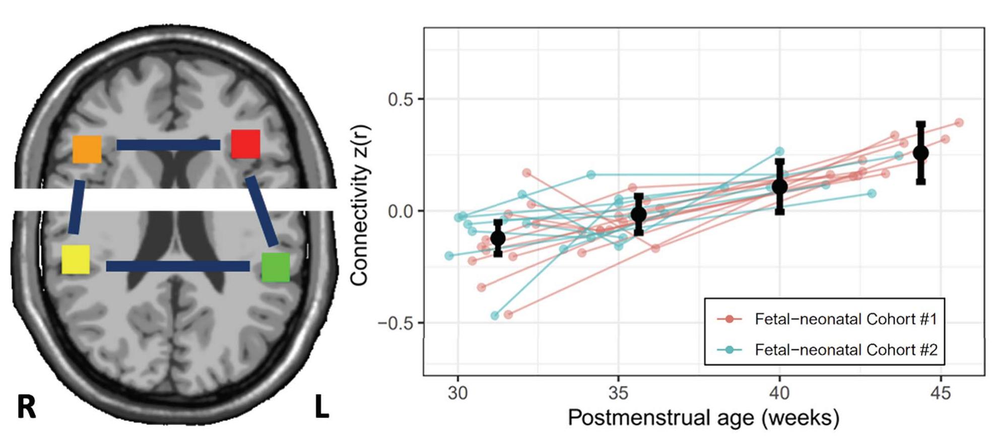 (PDF) Functional connectivity for the language network in the ...