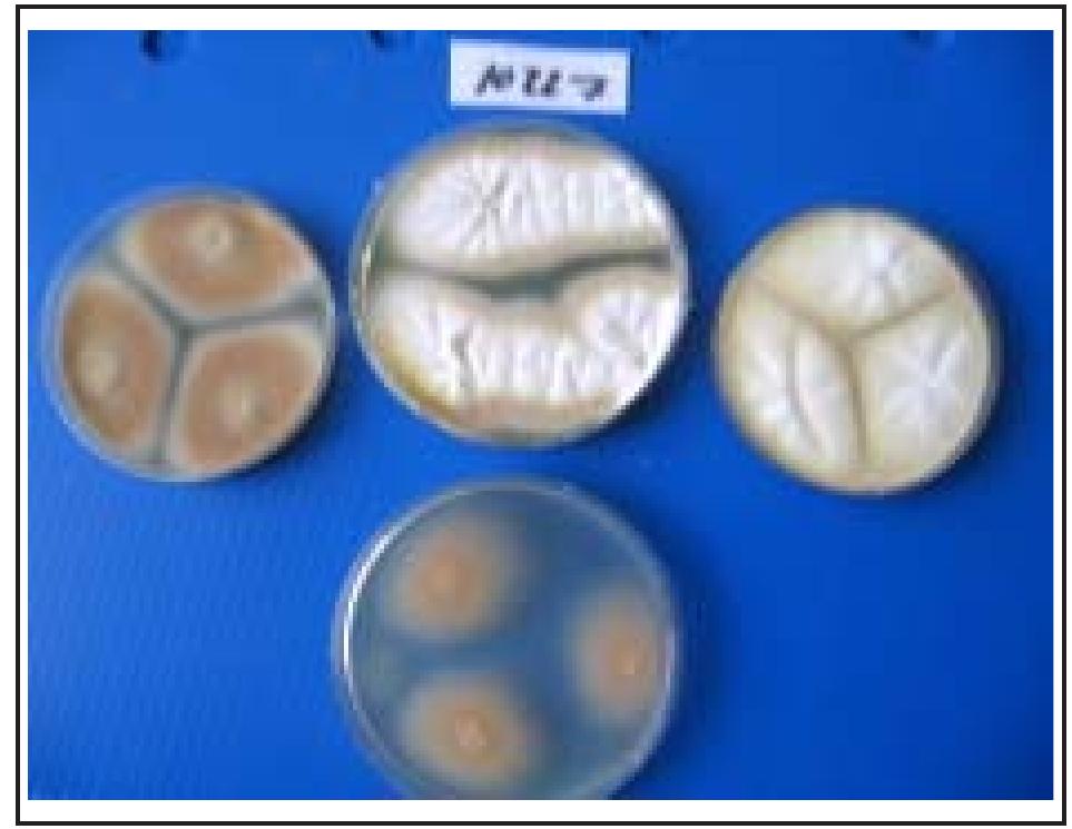 (PDF) Identification of Aspergillus Species Using Morphological ...
