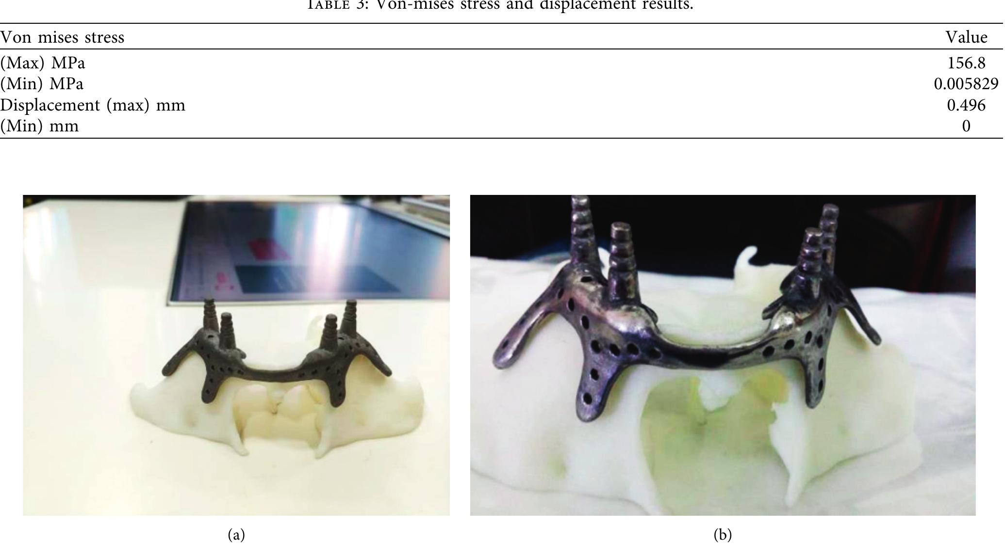 (PDF) Design and Fabrication of Patient-Specific Implant for ...