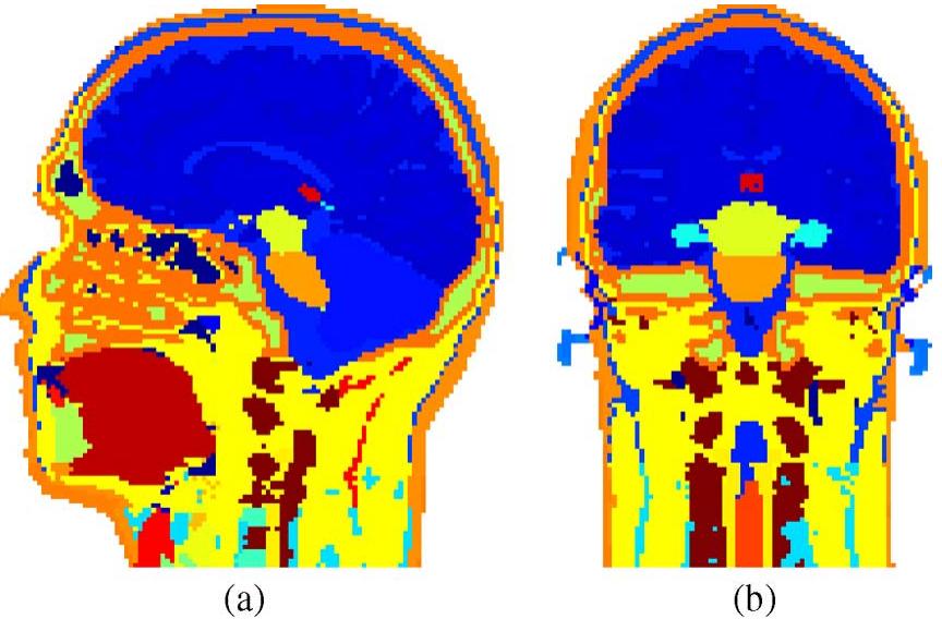 Finite model of the head in the (a) sagittal and (b) coronal