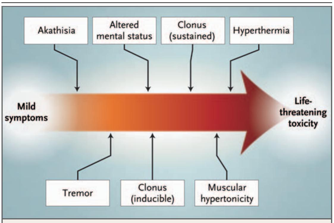 Muscle Hypertonicity Example Figure 3 - from The Serotonin Syndrome