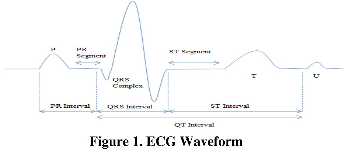 (PDF) A Fuzzy Based Approach for Denoising of ECG Signal using Wavelet ...