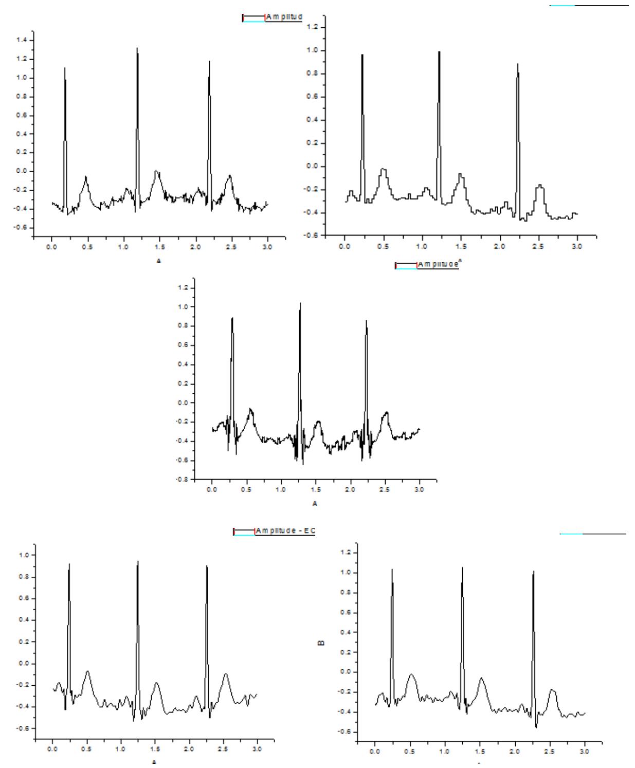 (PDF) A Fuzzy Based Approach for Denoising of ECG Signal using Wavelet ...
