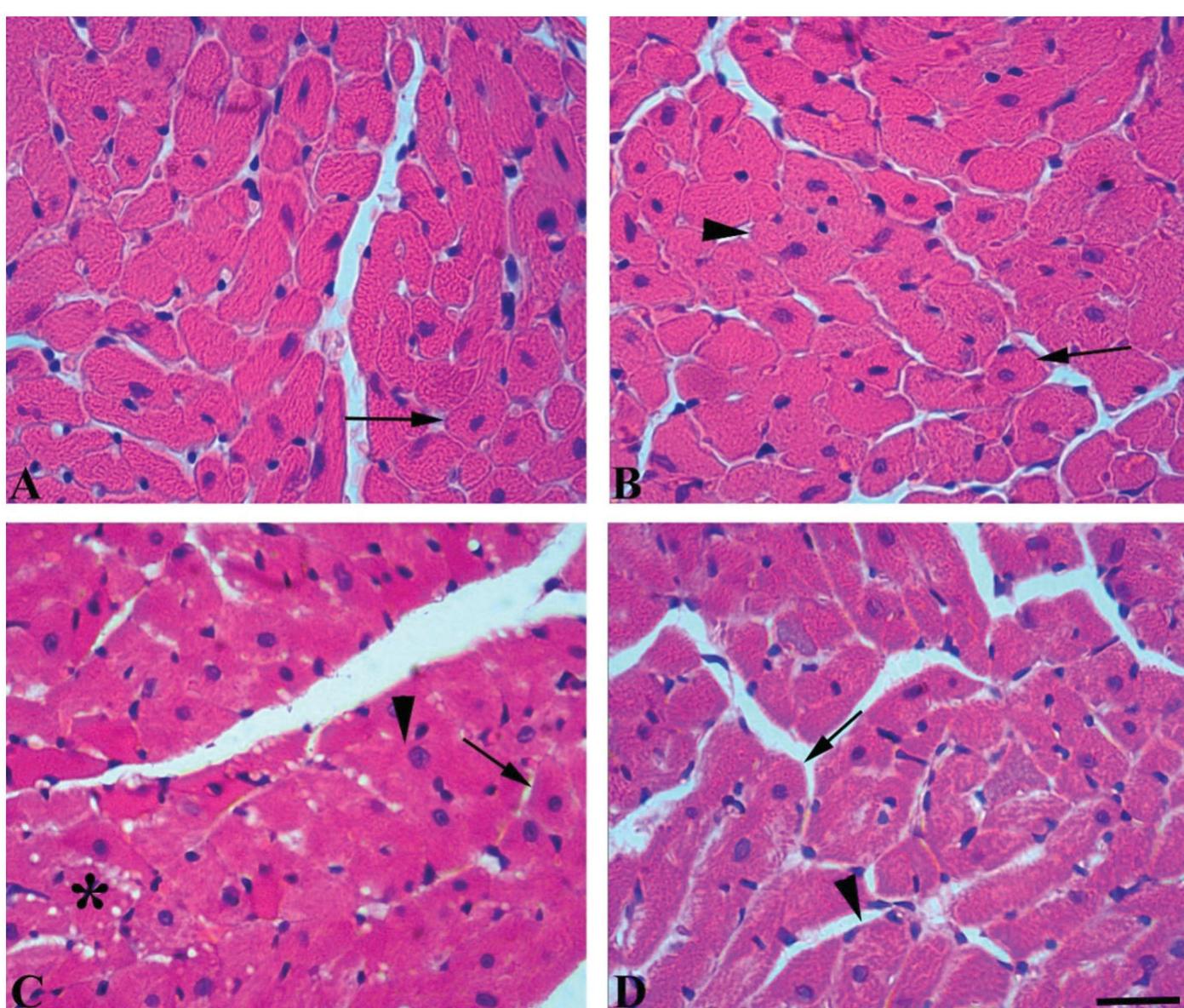 Photomicrographs of transverse sections of left ventricular