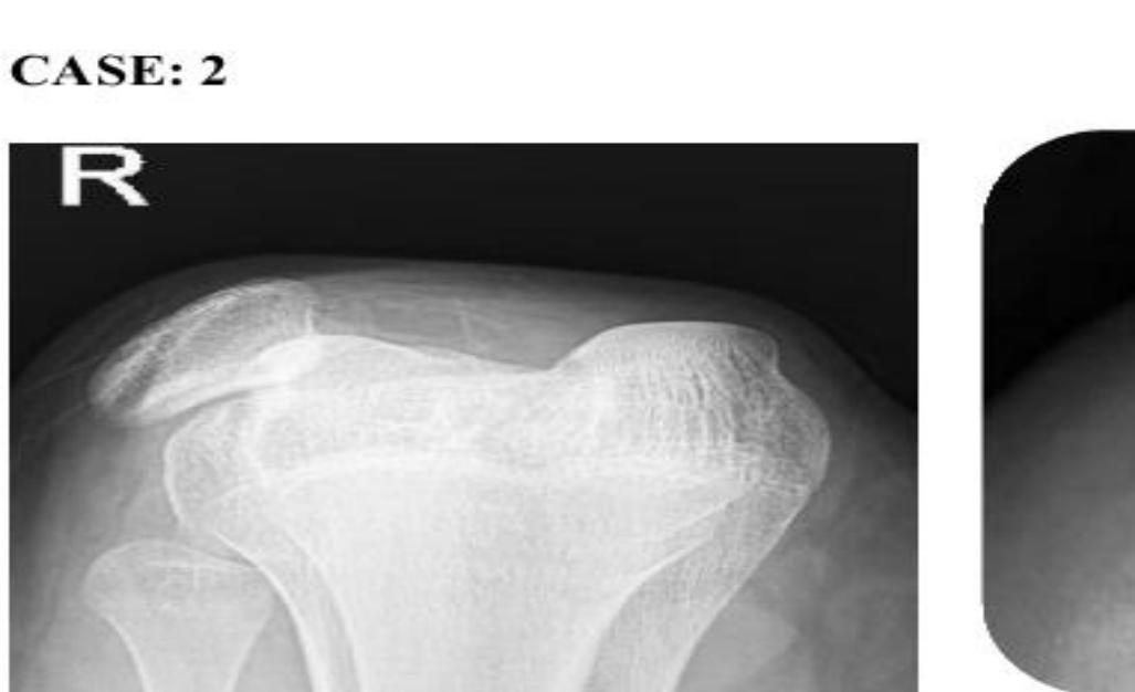Pre-operative radiographs