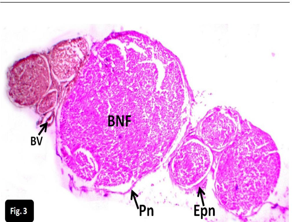 A photomicrograph of a cross-sectioned sciatic nerve from a