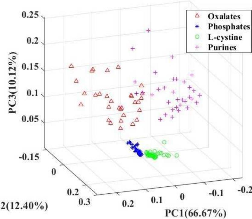 Keyney Raman (PDF) Analysis and classification of kidney stones based on Raman ...