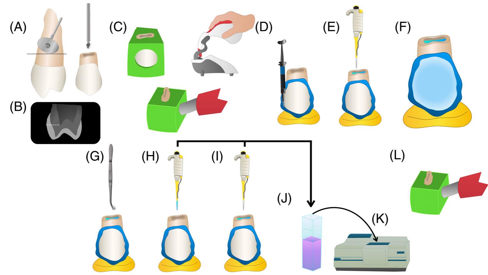 (PDF) A novel carbamide peroxide polymeric nanoparticle bleaching gel ...