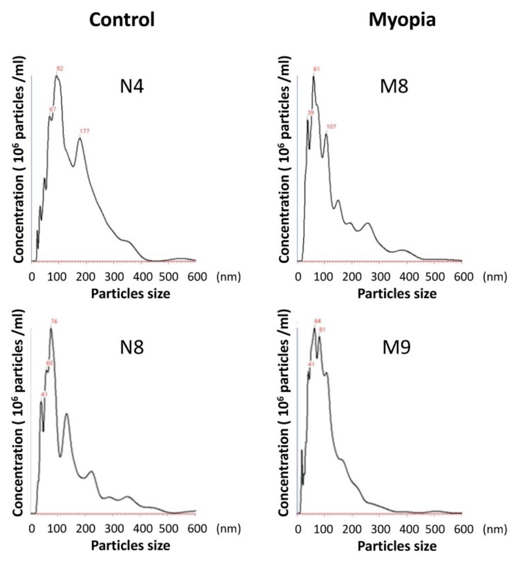 (PDF) Proteomic analysis of Exosomes derived from the Aqueous Humor of ...