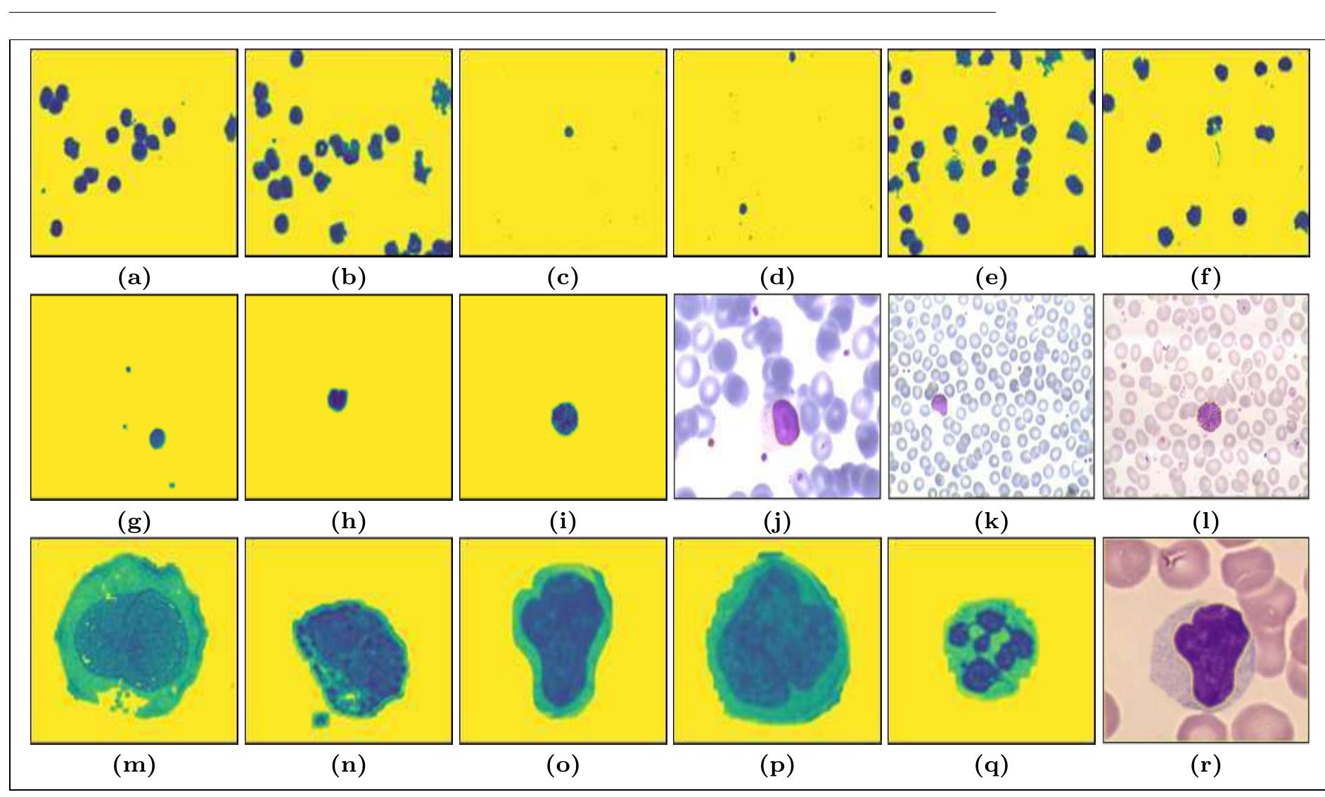 (PDF) An Automated Segmentation of Leukocytes Using Modified Watershed ...
