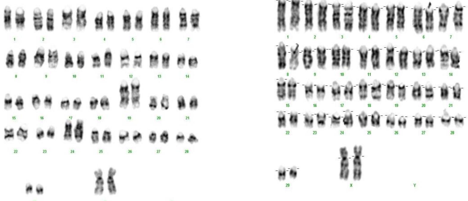 (PDF) The Comparison of Chromosome Analysis Result by Manual and ...