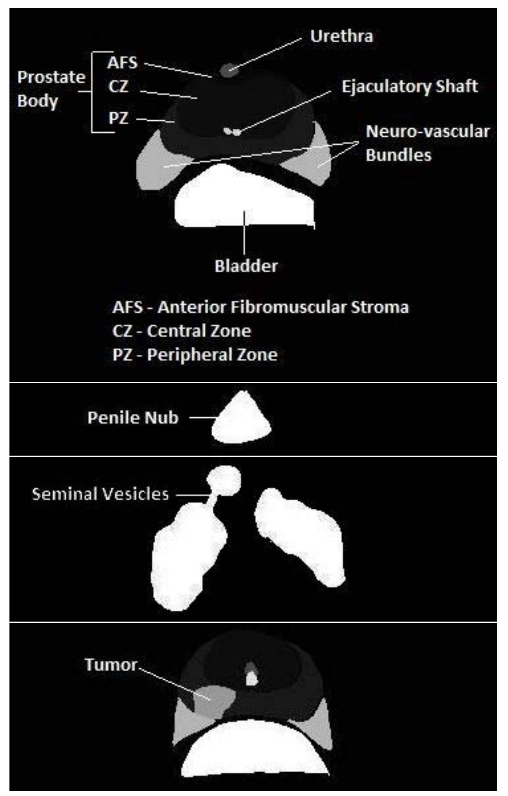 Figure 2 - from Constructing 3D-Printable CAD Models of