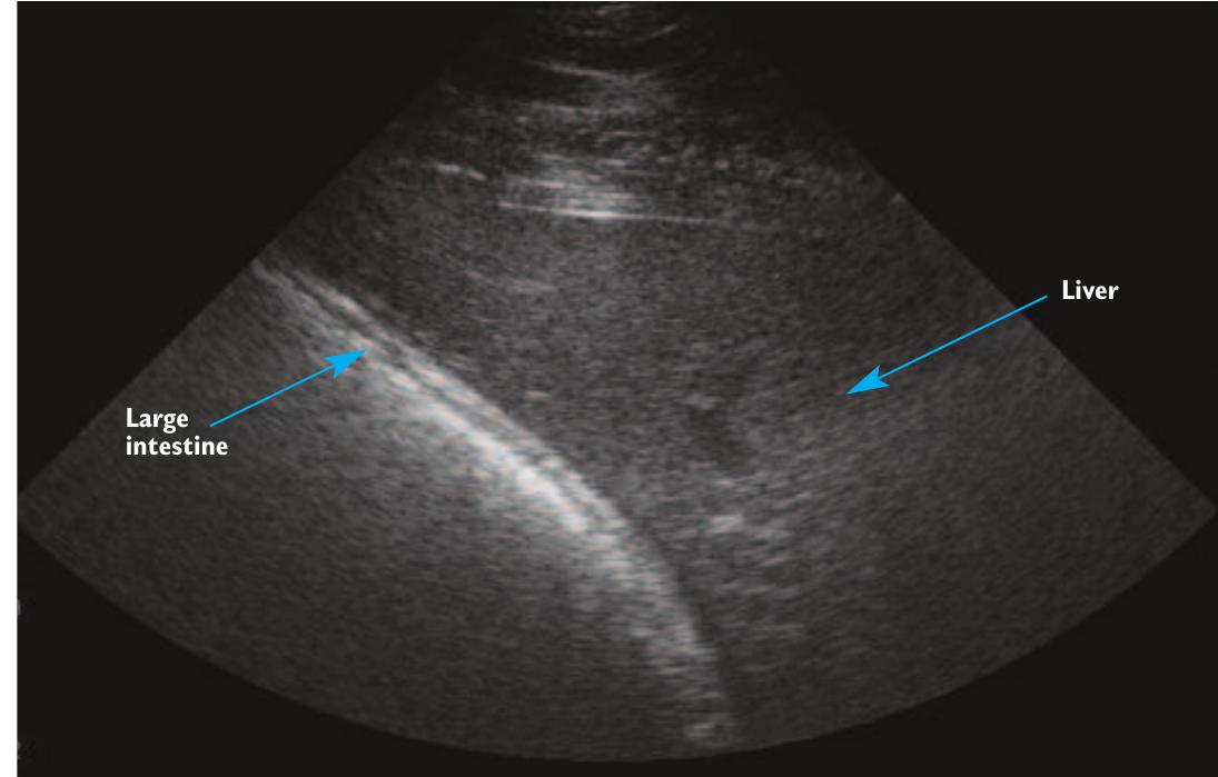 Transcutaneously (PDF) Ultrasonography of the normal adult equine abdomen
