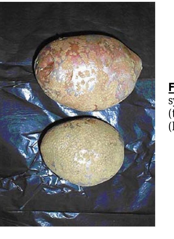 (PDF) Characterization of Streptomyces Scabies Isolated from Common ...