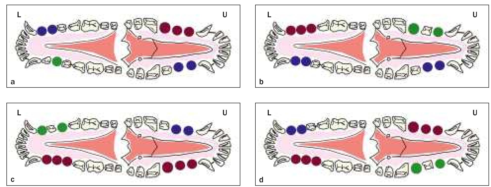 2 Dimensional Ridge Figure 2 - from Dimensional ridge alterations following