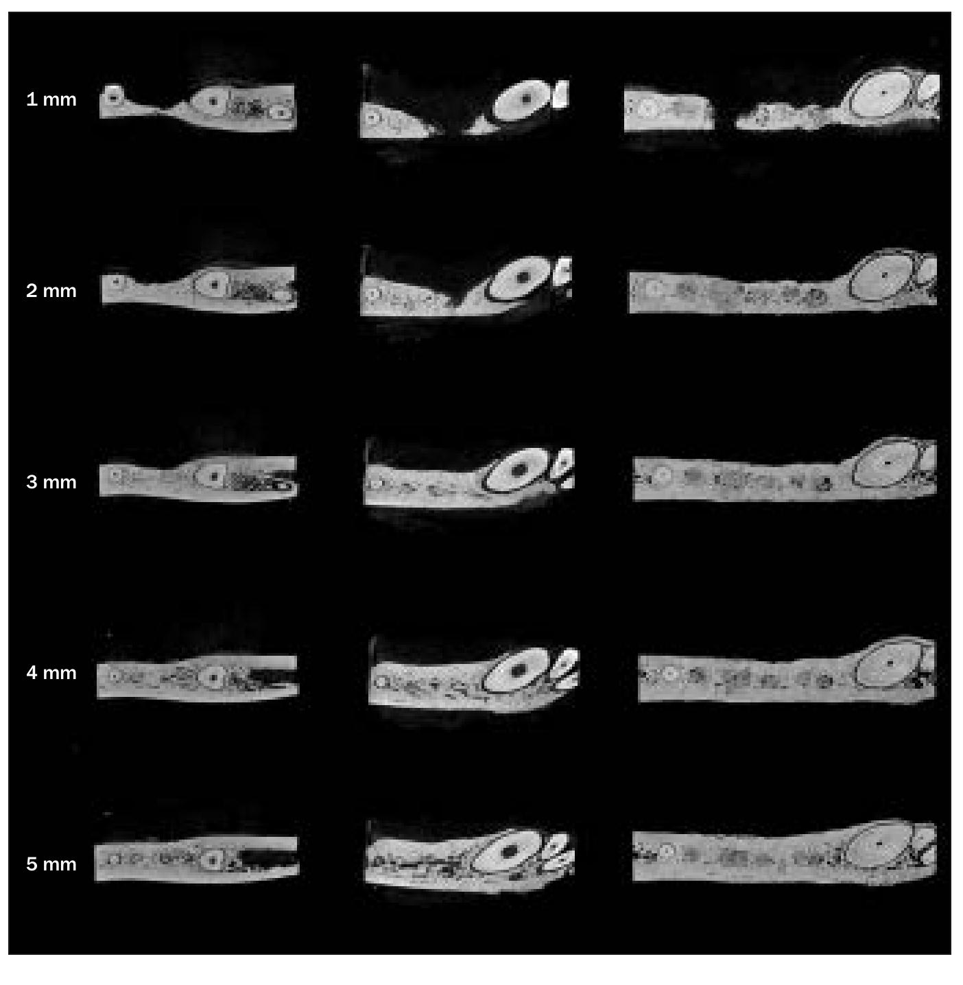 Able 1 linear measurements of bone width apical to the cej