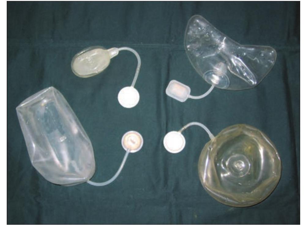 Different types of tissue expanders the standard tissue