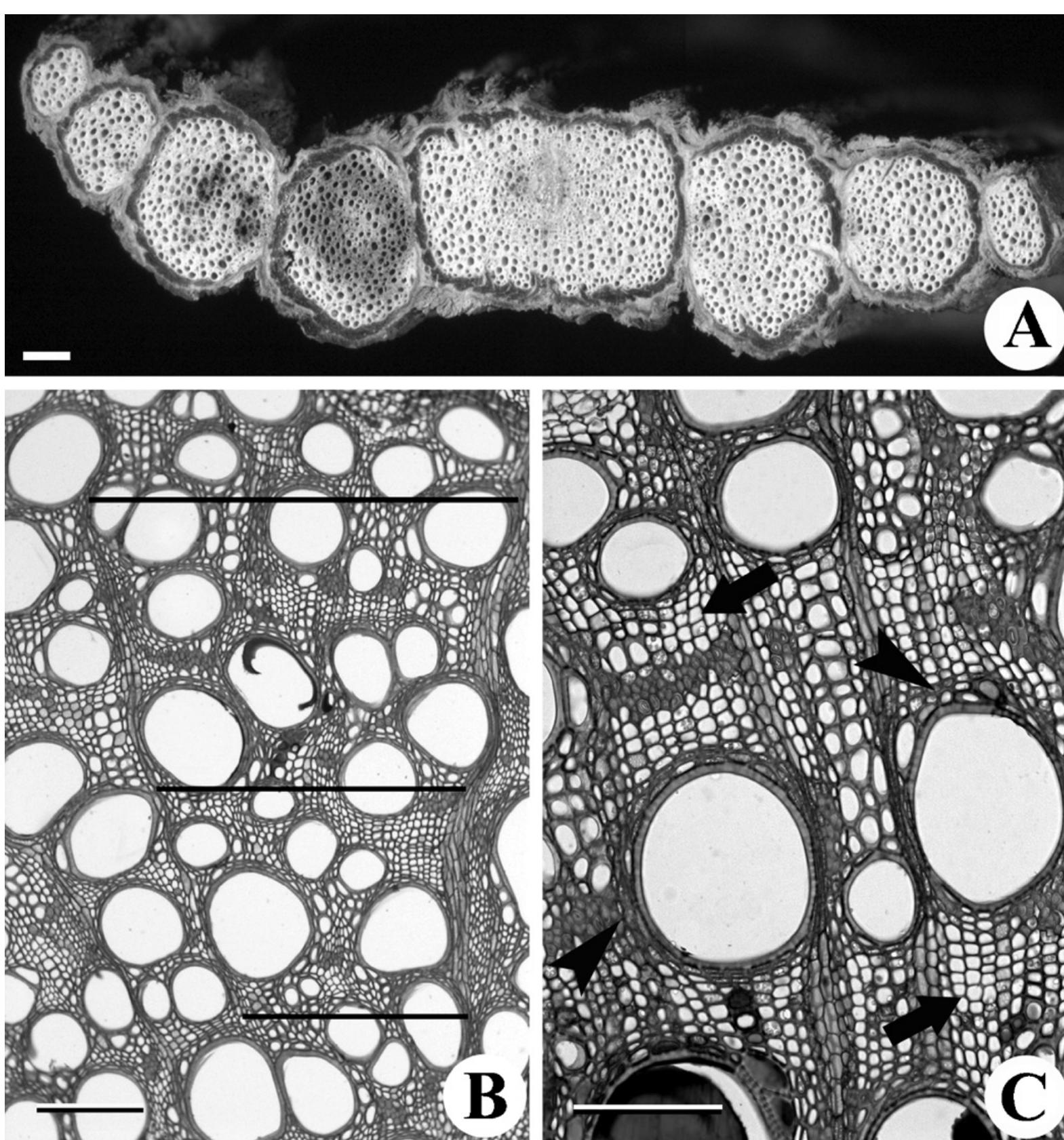 Viewing Transversely Transverse view of the stem and structure of secondary xylem