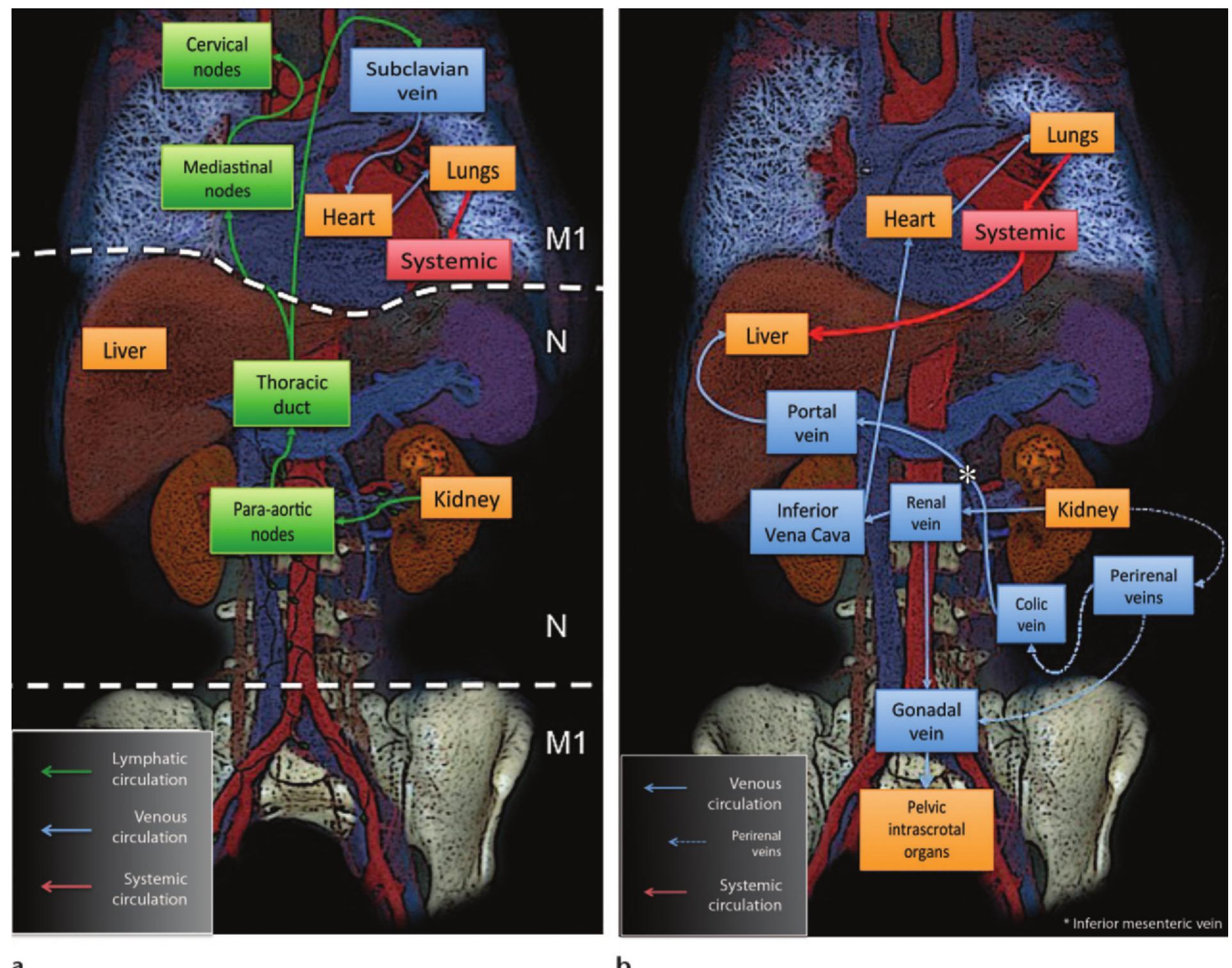 Routes of metastatic spread and most common sites of rcc