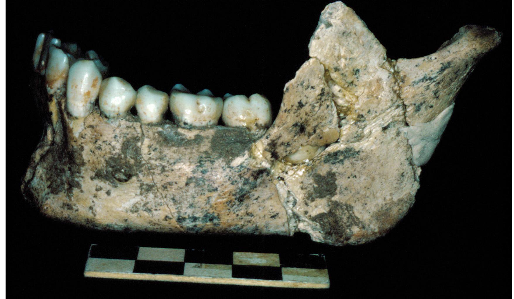Figure 3. Left lateral view of mandible with permanent teeth in situ of a subadult (ca.17 years) Pro- to-Neolithic individual, showing aspects of dento-alveolar morphoanatomic characteristics; here to focus on the supragingival plaque buildup and the slight dental wear patterns mainly on the buccal  cusps of the posterior teeth, relevant to and reflective of the good preparation quality of dietary intaka 