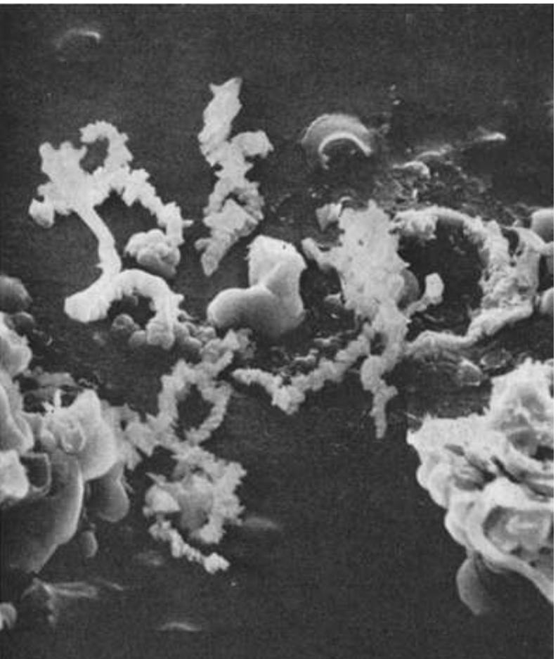 Proxamately Metaphase lyophilized chromosomes. note the definite