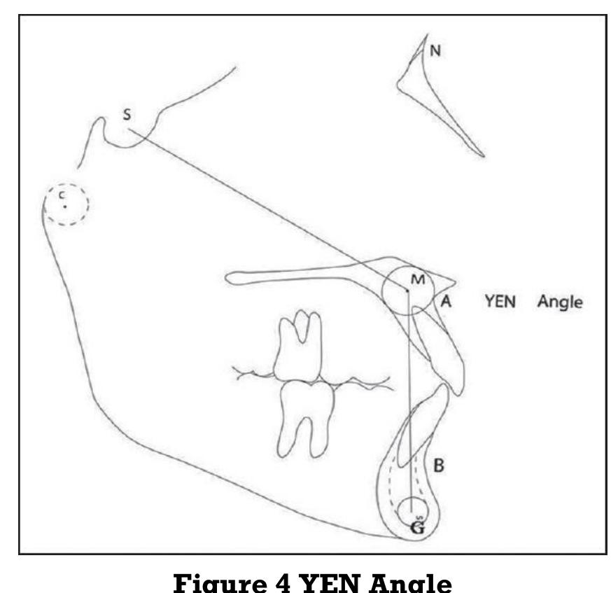 (PDF) Comparison Between the Wits Appraisal , the Beta Angle & Yen ...
