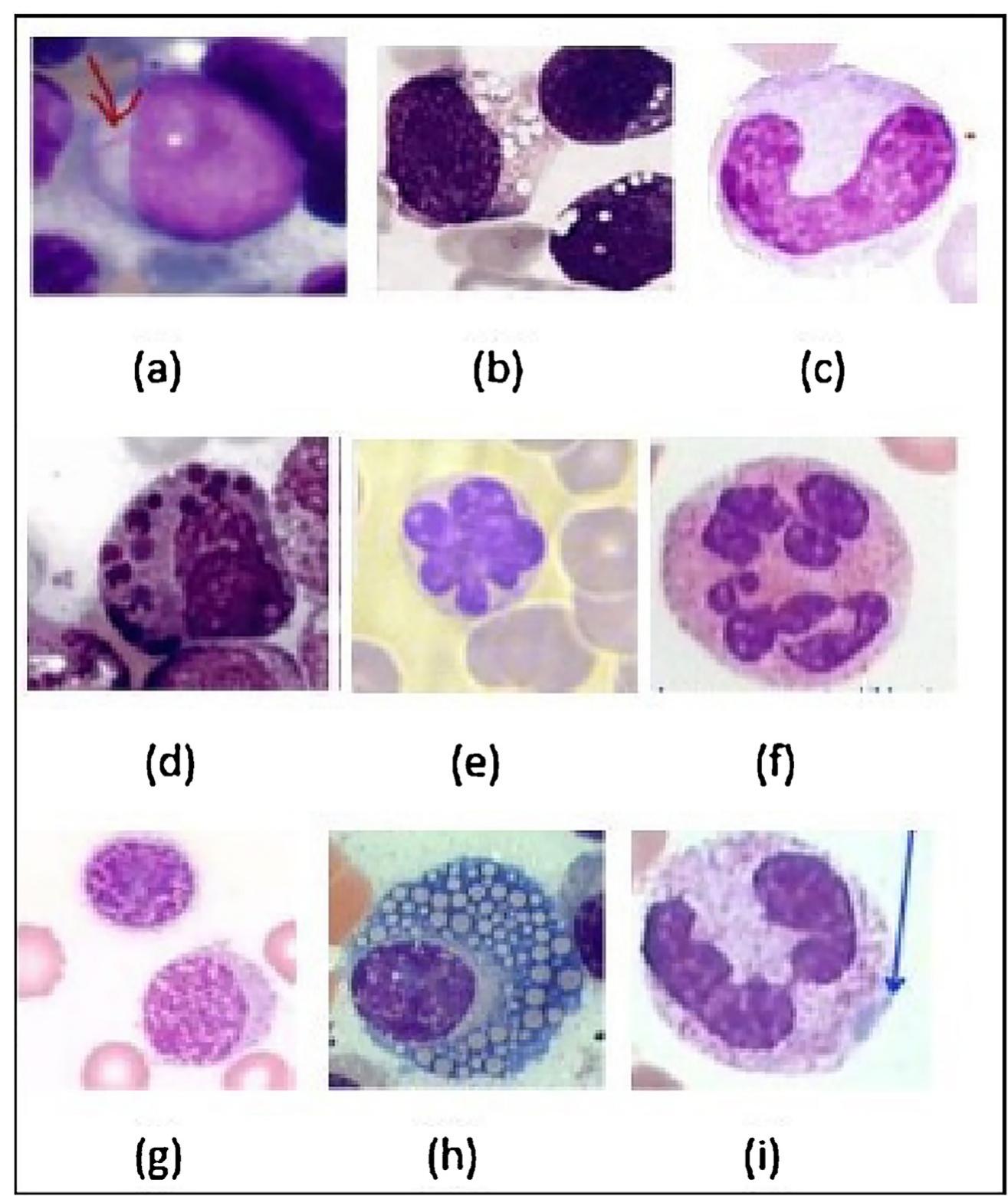 Table 2 - from Peripheral blood smear analysis using image