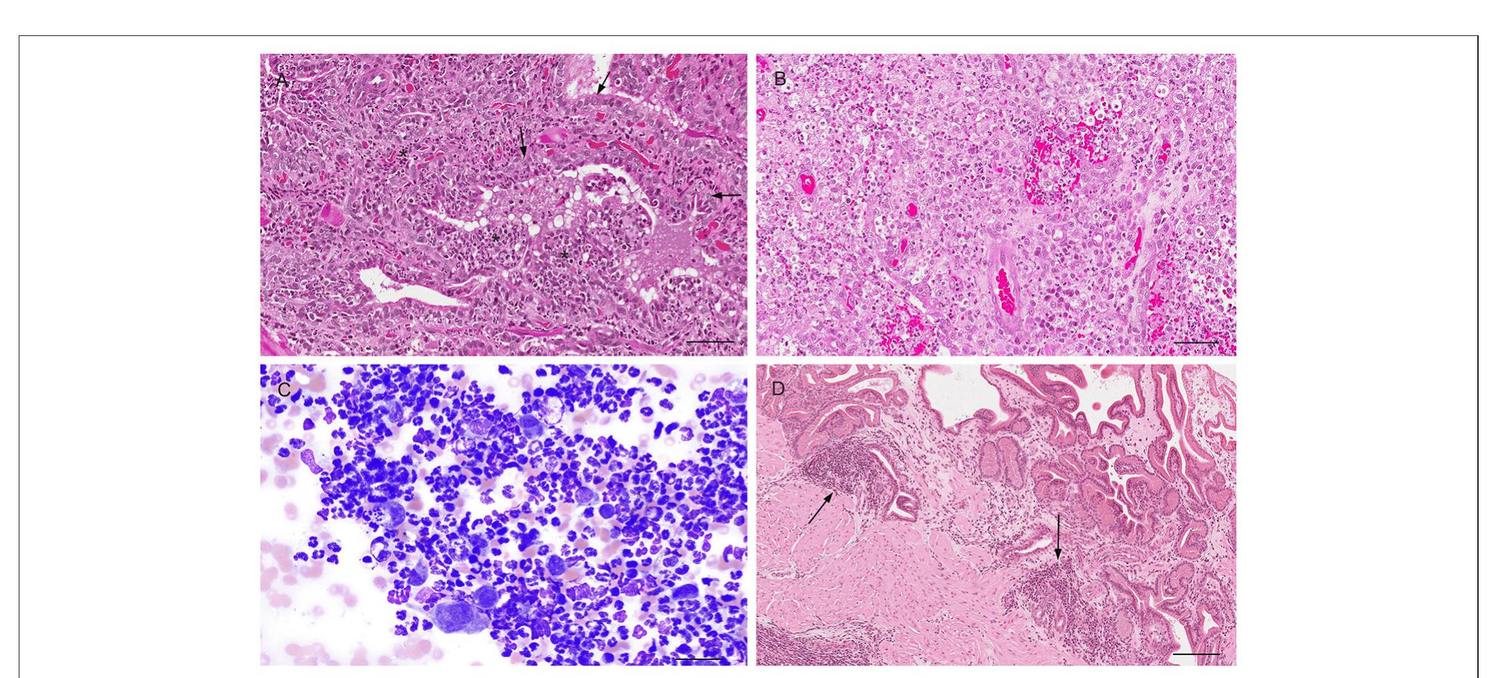 | histological (a,b,d) and cytological (c) features of three