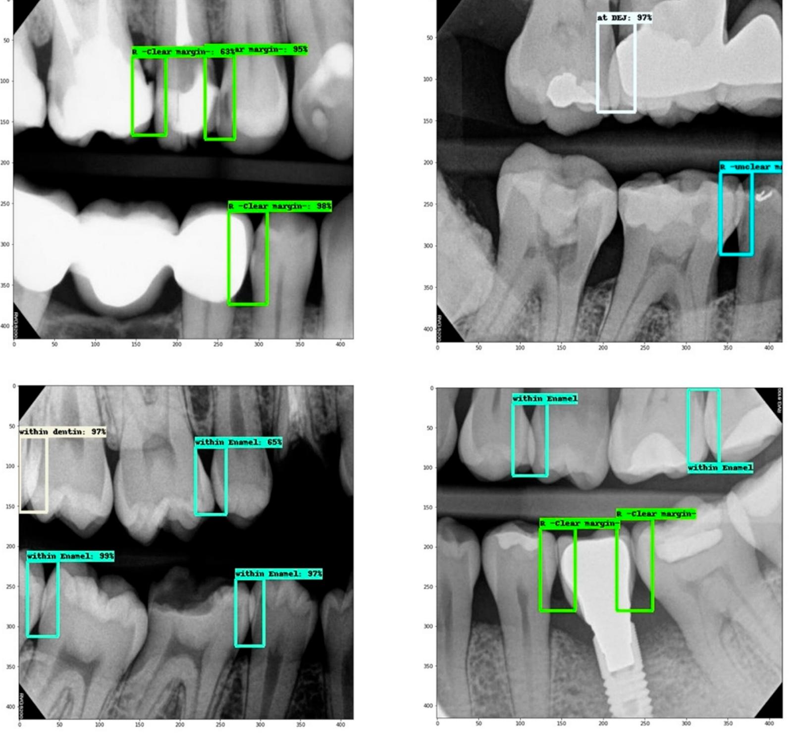 (PDF) Effectiveness of Machine Learning in Assessing the Diagnostic ...