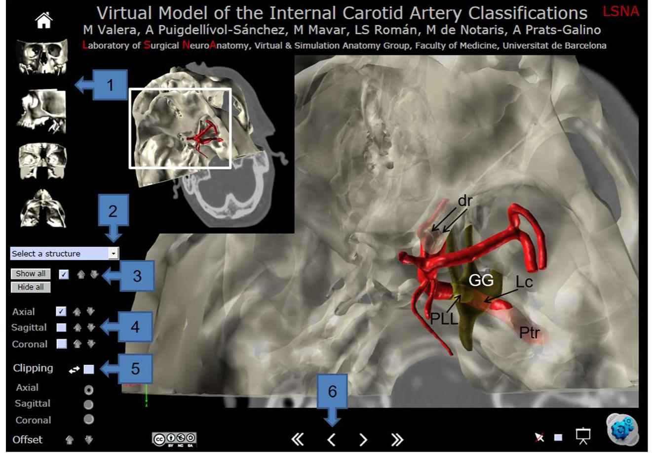 (PDF) Review of the main surgical and angiographic-oriented ...