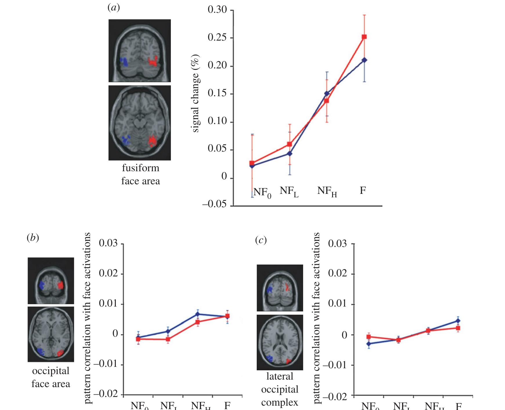 (PDF) Lateralization of face processing in the human brain