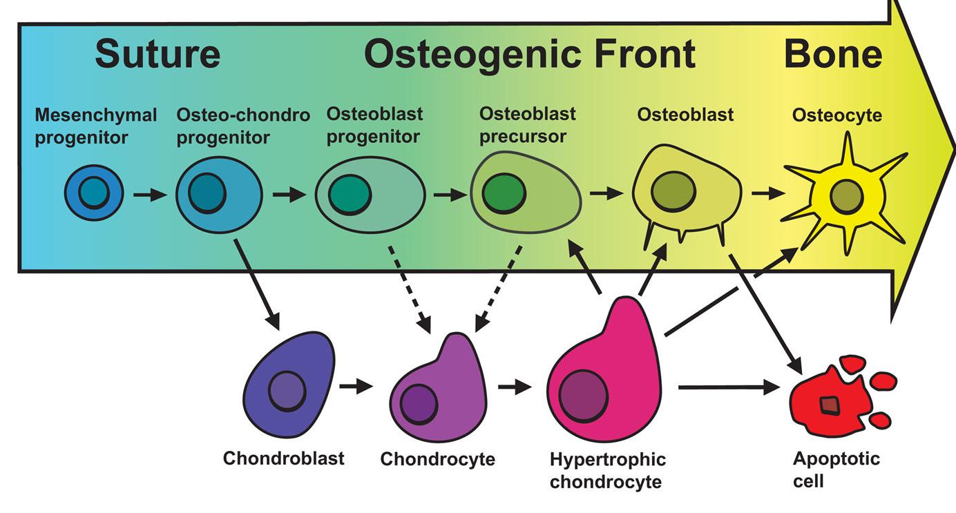Figure 5 - from Understanding craniosynostosis as a growth