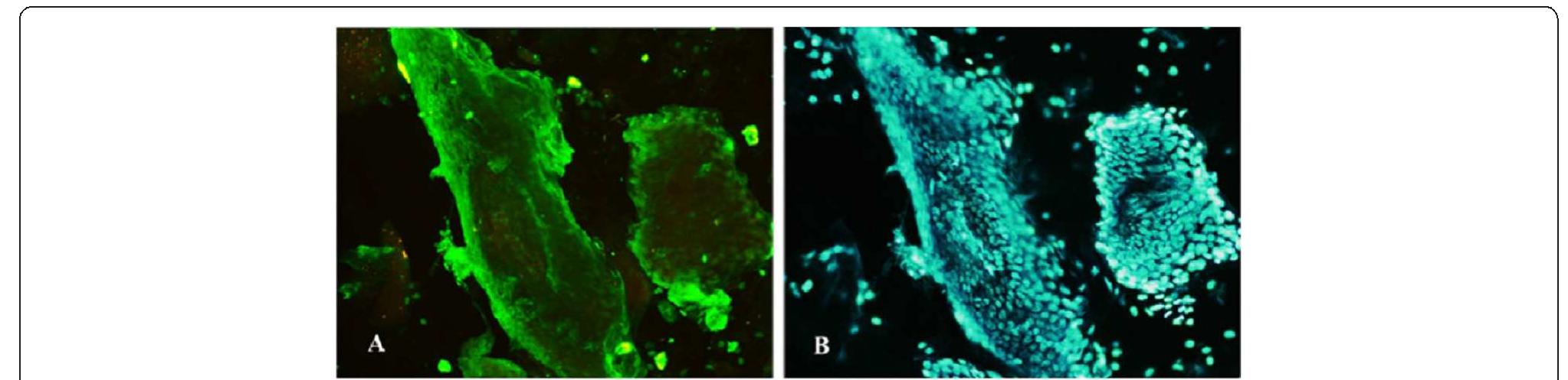 Immunofluorescence staining of nasal mucosae samples (20x).