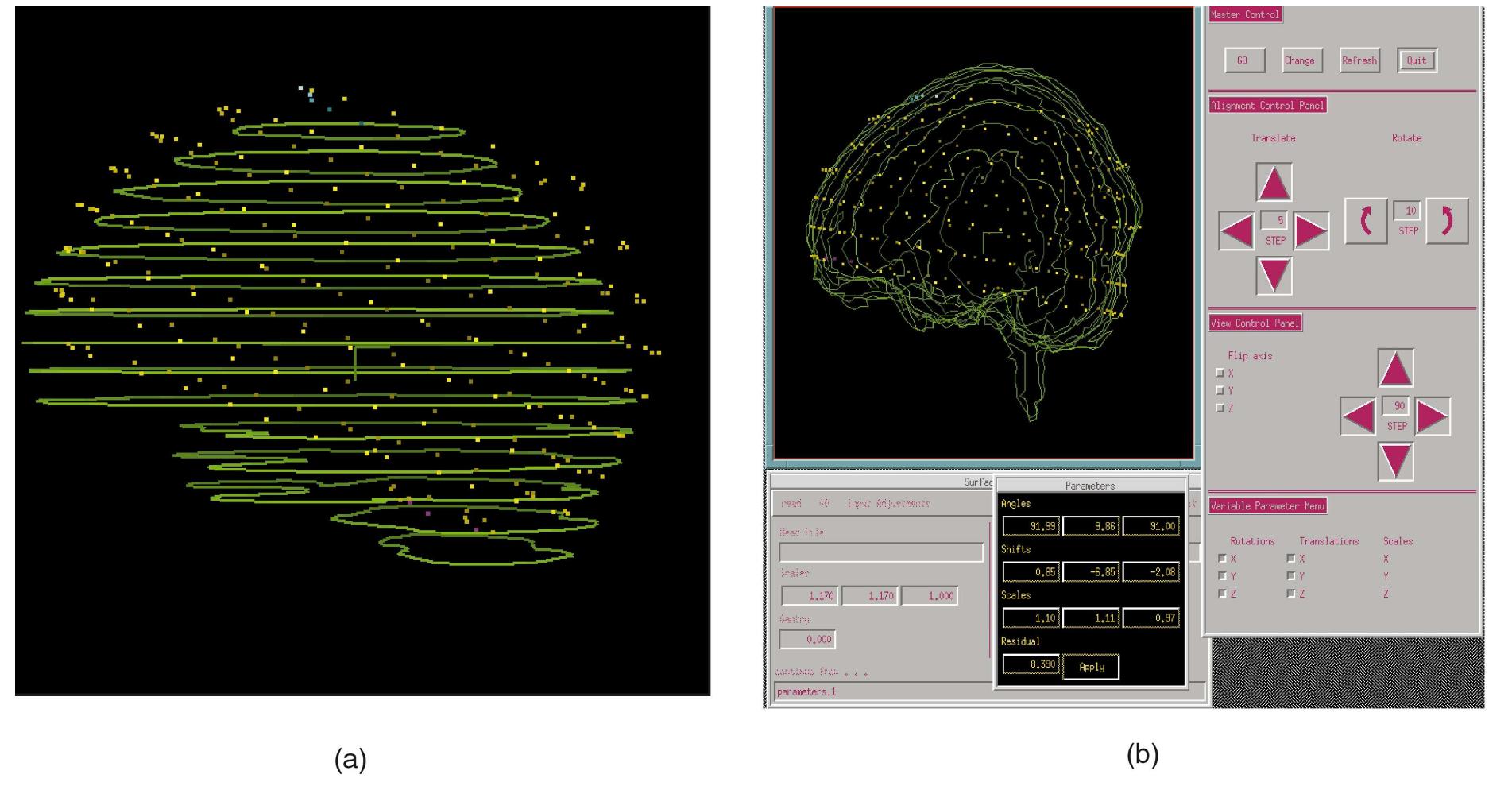 Surface-based registration of a mri dataset with a pet