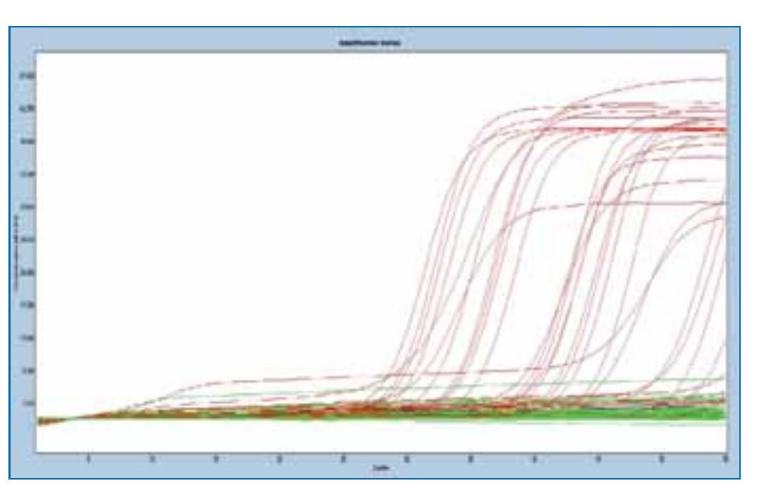 Spap Complex (PDF) spaP gene of Streptococcus mutans in dental plaque and its ...
