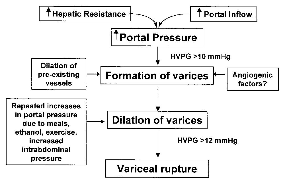 Varices Pathogenesis Natural history of esophageal varices as a function of