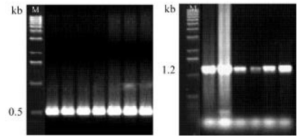 Gel electrophoresis of polymerase chain reaction (pcr)